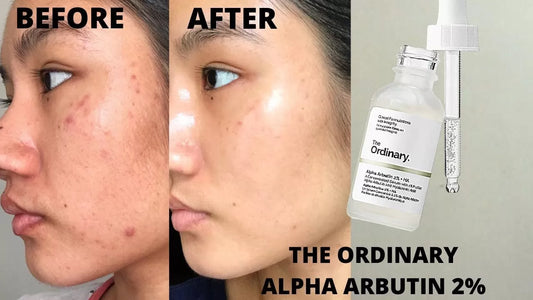The Ordinary Alpha Arbutin 2% + HA Serum – Brightening & Hydrating Treatment